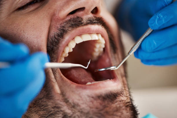 Best Teeth Whitening  in Vidalia, LA
